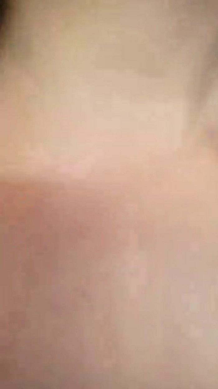 Melacam