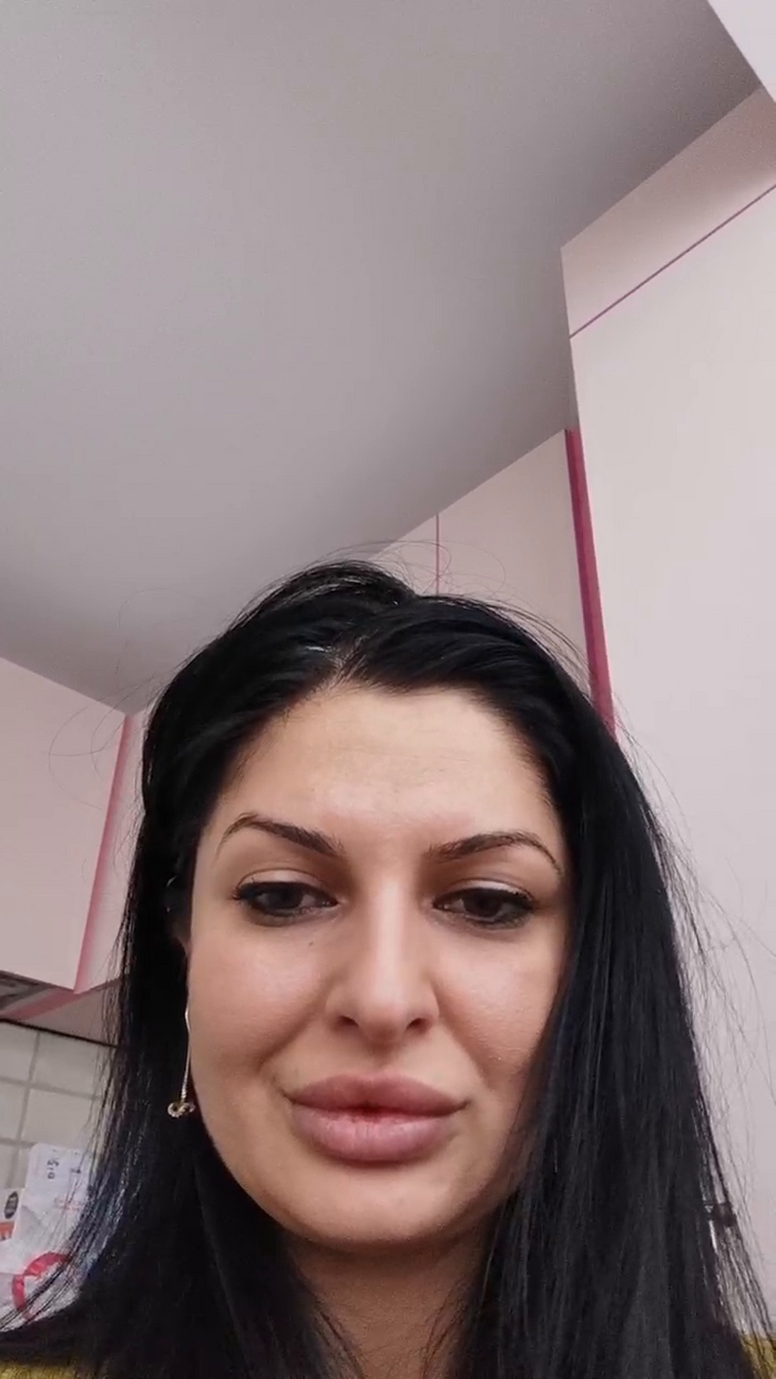 brownieskin