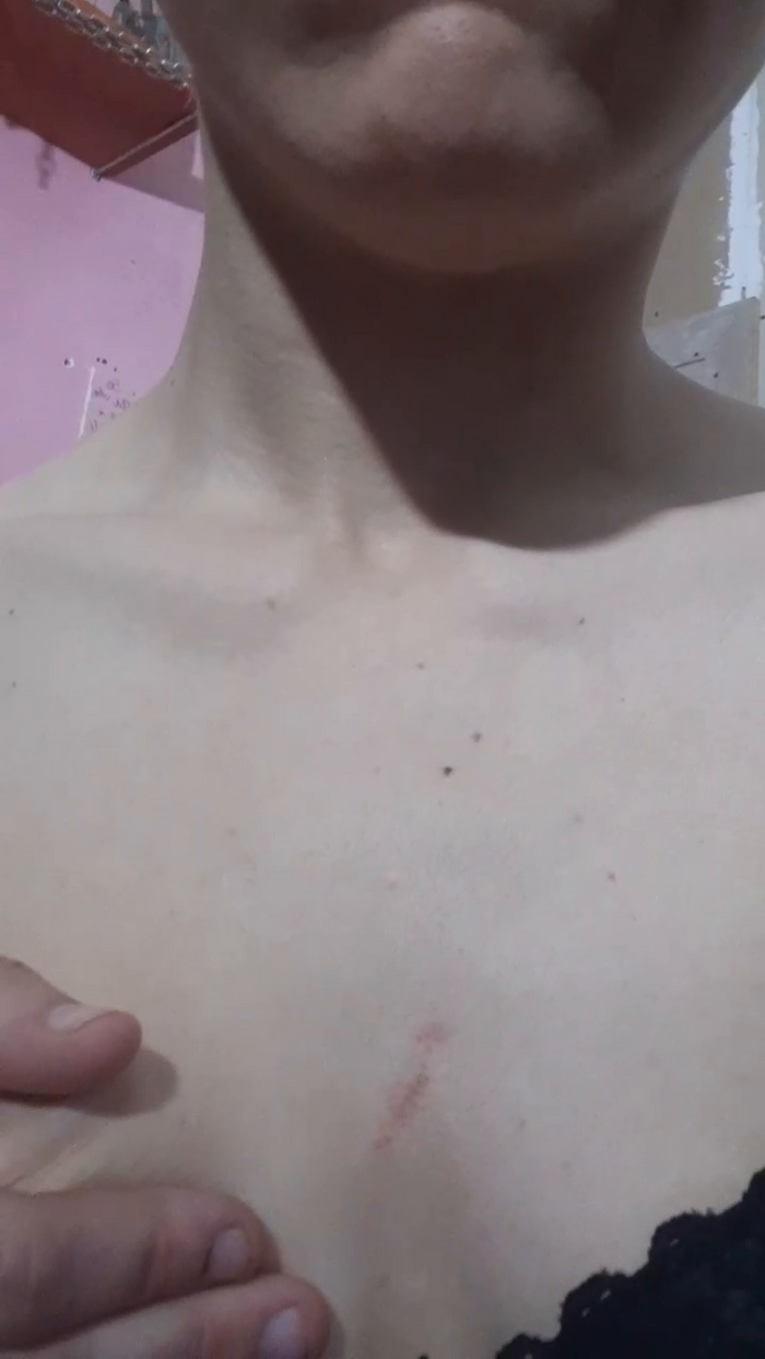 LaLiceale5