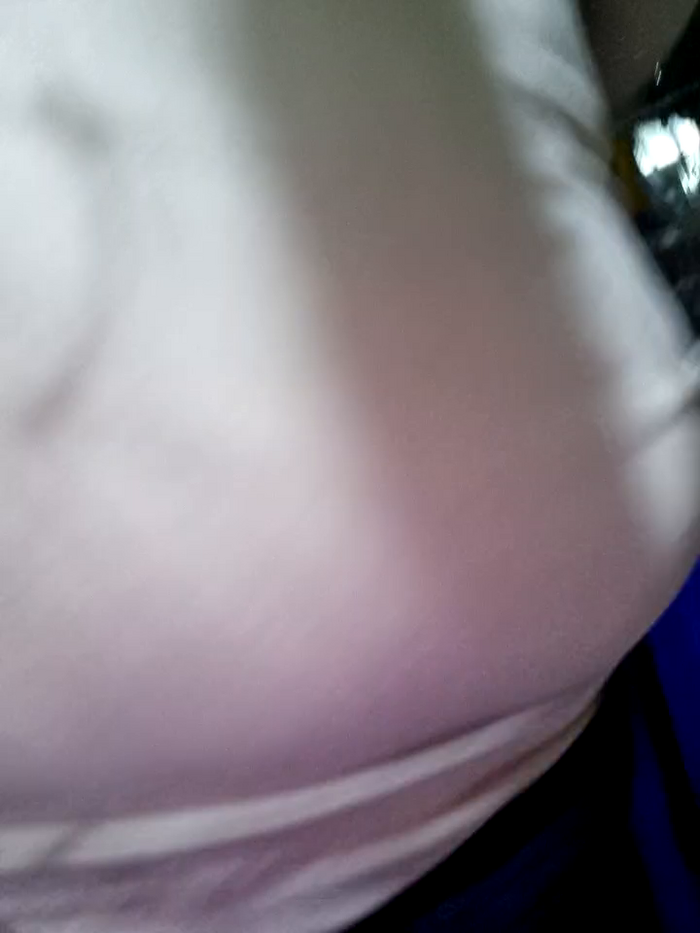 _mia17_